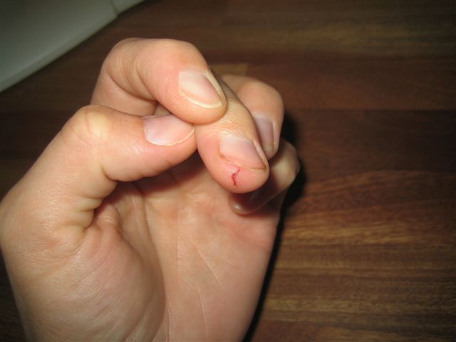 Ouch my finger!